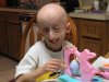 progeria3.jpg